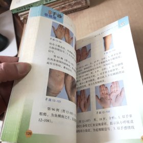 图解手诊看健康