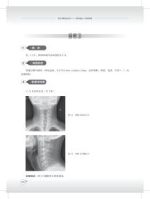 积水潭放射读片——骨肿瘤之中轴骨篇