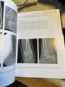 小儿骨科手术学 第2版