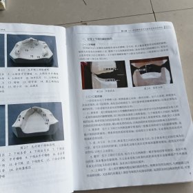 可摘义齿修复工艺技术（第4版/中职口腔）