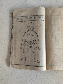 江西永丰 胡梅早春氏 刻本医学资料《邵氏痘科》单册内容共35页内容