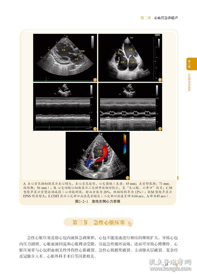 急诊超声检查入门手册 9787523507162