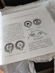 同仁眼科手术笔记