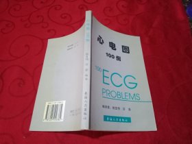 心电图100例
