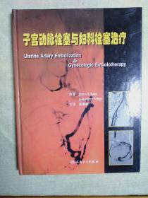 子宫动脉栓塞与妇科栓塞治疗