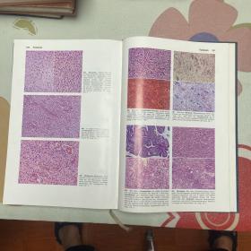 Atlas der pathologischen Anatomie病理解剖图谱(品自鉴）