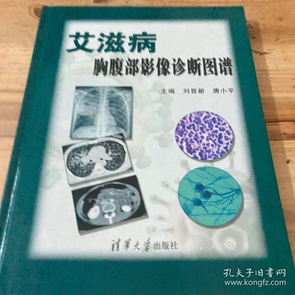 艾滋病胸腹部影像诊断图谱