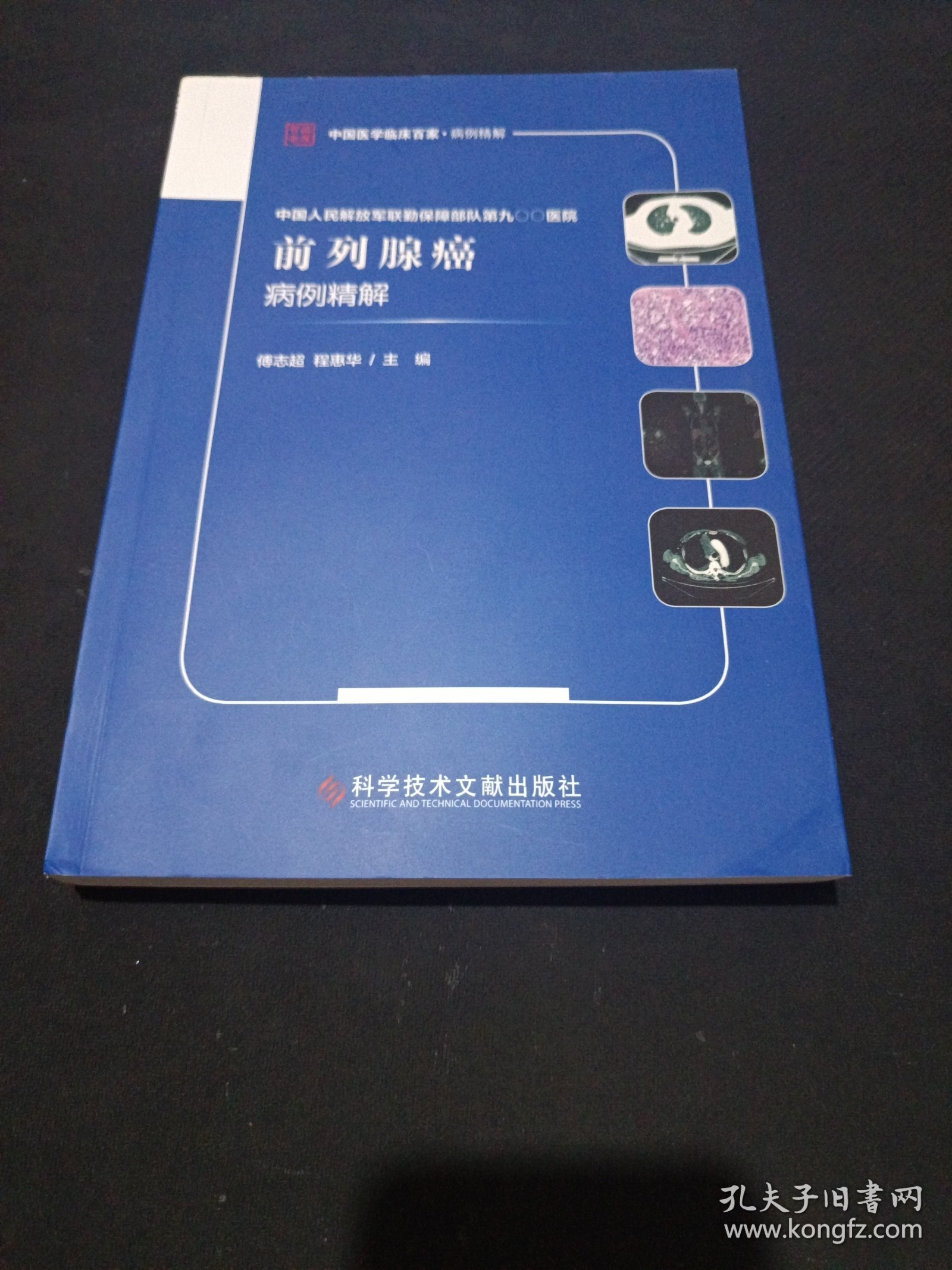 中国人民解放军联勤保障部队第九〇〇医院前列腺癌病例精解