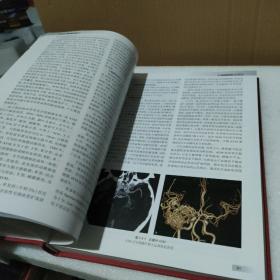 中华影像医学·中枢神经系统卷（第3版）【品如图】