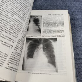 普通胸部外科学（上、下）