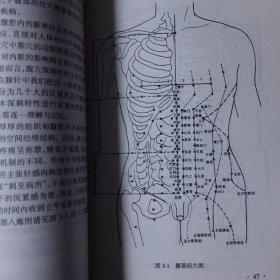 腹针疗法(作者签赠本)