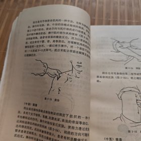 推拿疗法与医疗练功(本书详细介绍25种推拿手法以及医疗练功的方法，全书插图245幅，文图对照，易于学习。J架2排右)