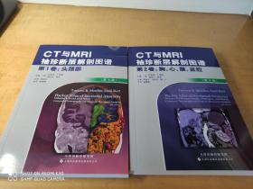CT与MR袖珍断层解剖图谱（第一卷第二卷）两册合售包邮
