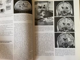 【英文原版】Interventional Magnetic Resonance Imaging 介入性磁共振成像