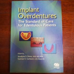 Implant  Overdentures  The standard OF  Care for  Edentulous Patients