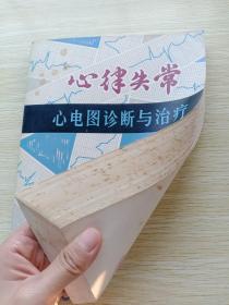 心律失常：心电图诊断与治疗