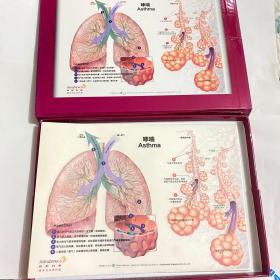 慢性阻塞性肺疾病.(COPD)