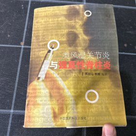 类风湿关节炎与强直性脊柱炎