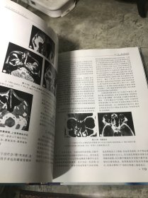 耳鼻咽喉影像诊断学