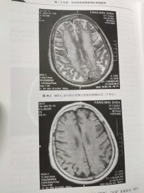 精装 现代神经内科学 李大年 原箱