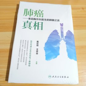 肺癌 真相——来自胸外科医生的肺腑之言