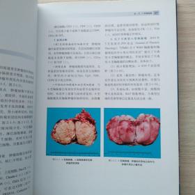 一版一印：《胸腺肿瘤病理学诊断图谱》