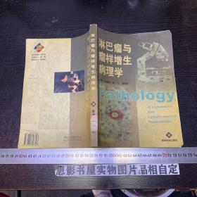 淋巴瘤與瘤樣增生病理學(xué)