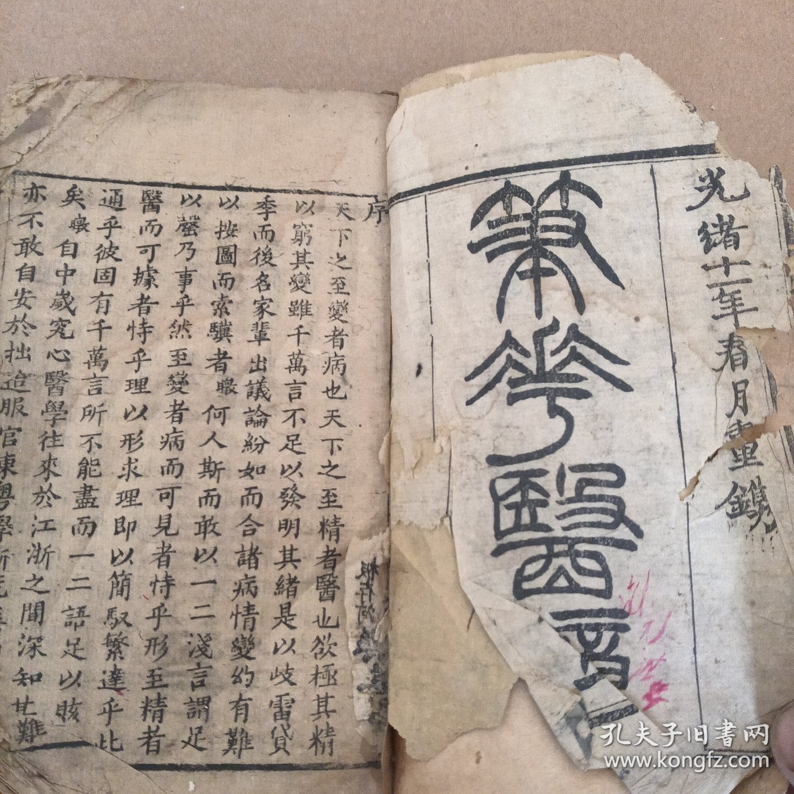 清代木刻笔花医镜（全卷）（有小部分破损）