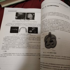 临床超声医学诊断精要