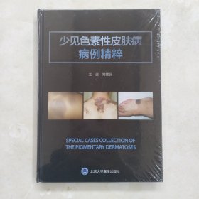 少见色素性皮肤病病例精粹