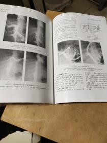 中华影像医学·介入放射学卷  内页干净无划线写字