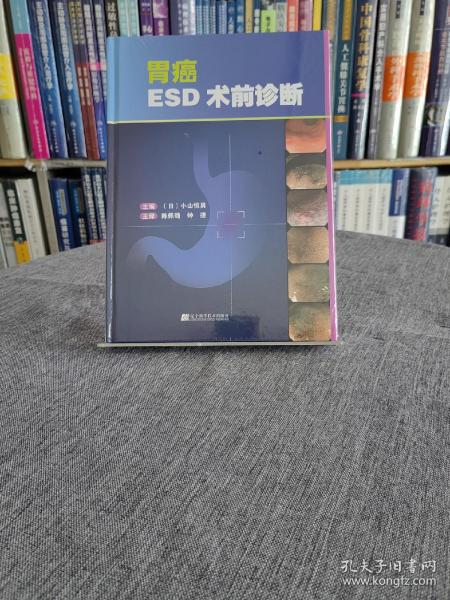 胃癌ESD术前诊断