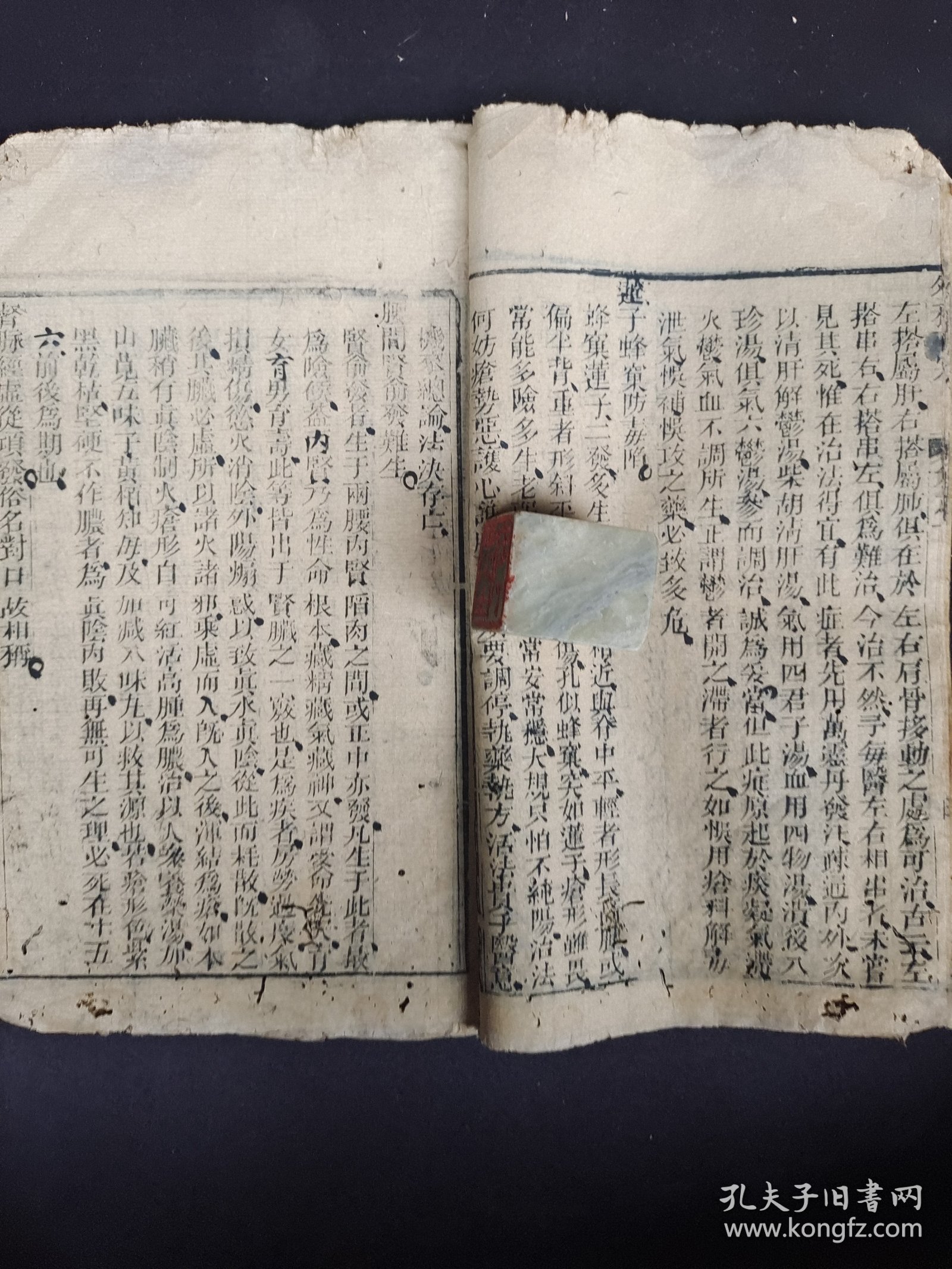 《外科正宗》卷一，清代木刻本。