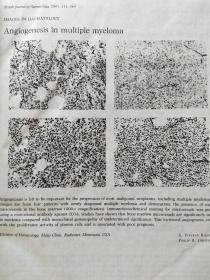 BRITISH JOURNAL OF HAEMA TOLOGY[071]英国血液学杂志 7本合售