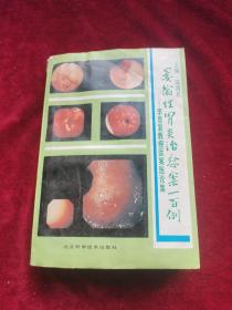 萎缩性胃炎治愈案100例:李恩复教授医案医论集