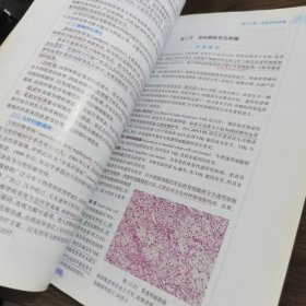 病理学第8版：十二五普通高等教育本科国家级规划教材