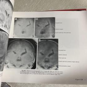 Normal Neuroradiology And Atlas of the Skull, Sinuses, and Facial Bones ，正常神经放射学 和颅骨（头骨）、鼻窦和面部骨骼图谱图集，大开本