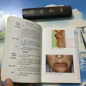 正版现货      口腔疾病     一版一印   详情阅图  介意者慎拍