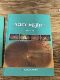 真彩超广角眼底图谱