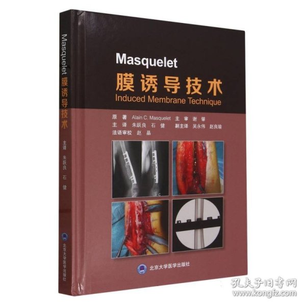 Masquelet 膜诱导技术