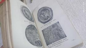中西医结合治疗急腹症 1973年