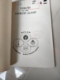 甲状腺肿瘤