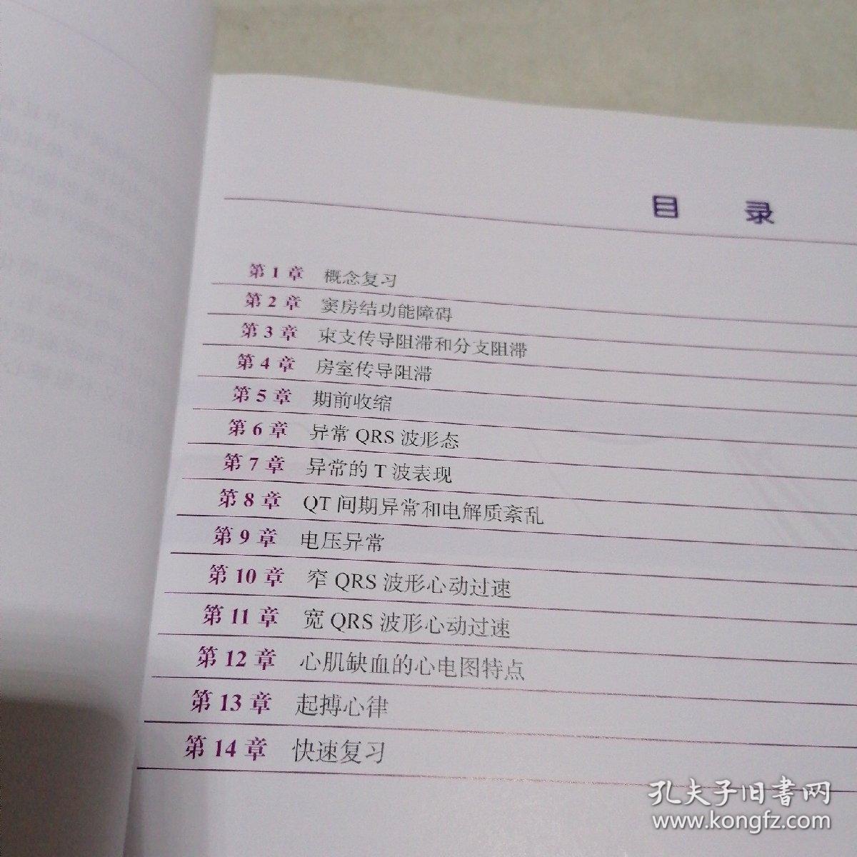 急诊心电图快速解读：心电图视觉记忆指南