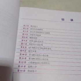 急诊心电图快速解读：心电图视觉记忆指南