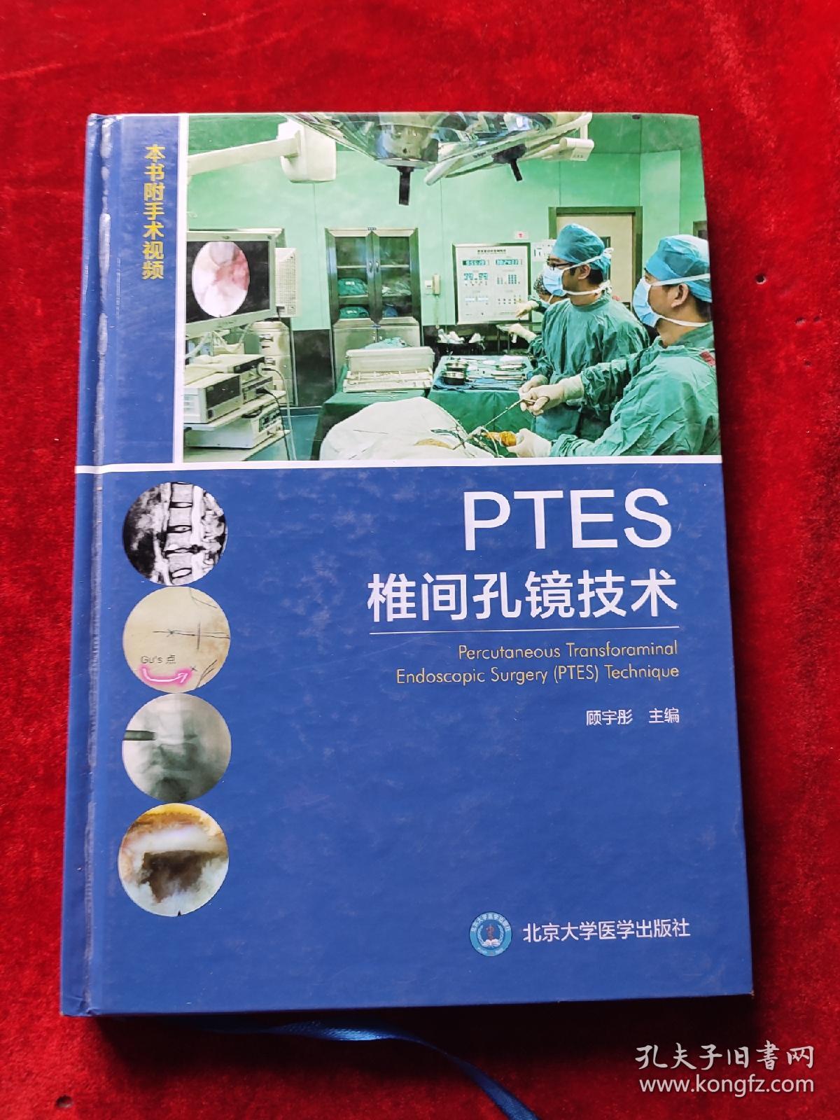 PTES椎间孔镜技术