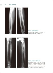 骨关节创伤X线诊断图谱（第4版） 9787117328548