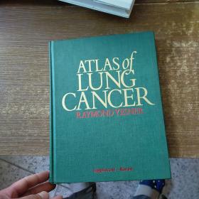 ATLAS OF LUNG CANCER RAYMOND YESNER   外文版实物拍图 现货