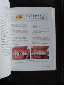 口腔种植学临床实践