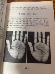 图解手相与诊病法