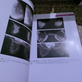 乳腺MRI手册